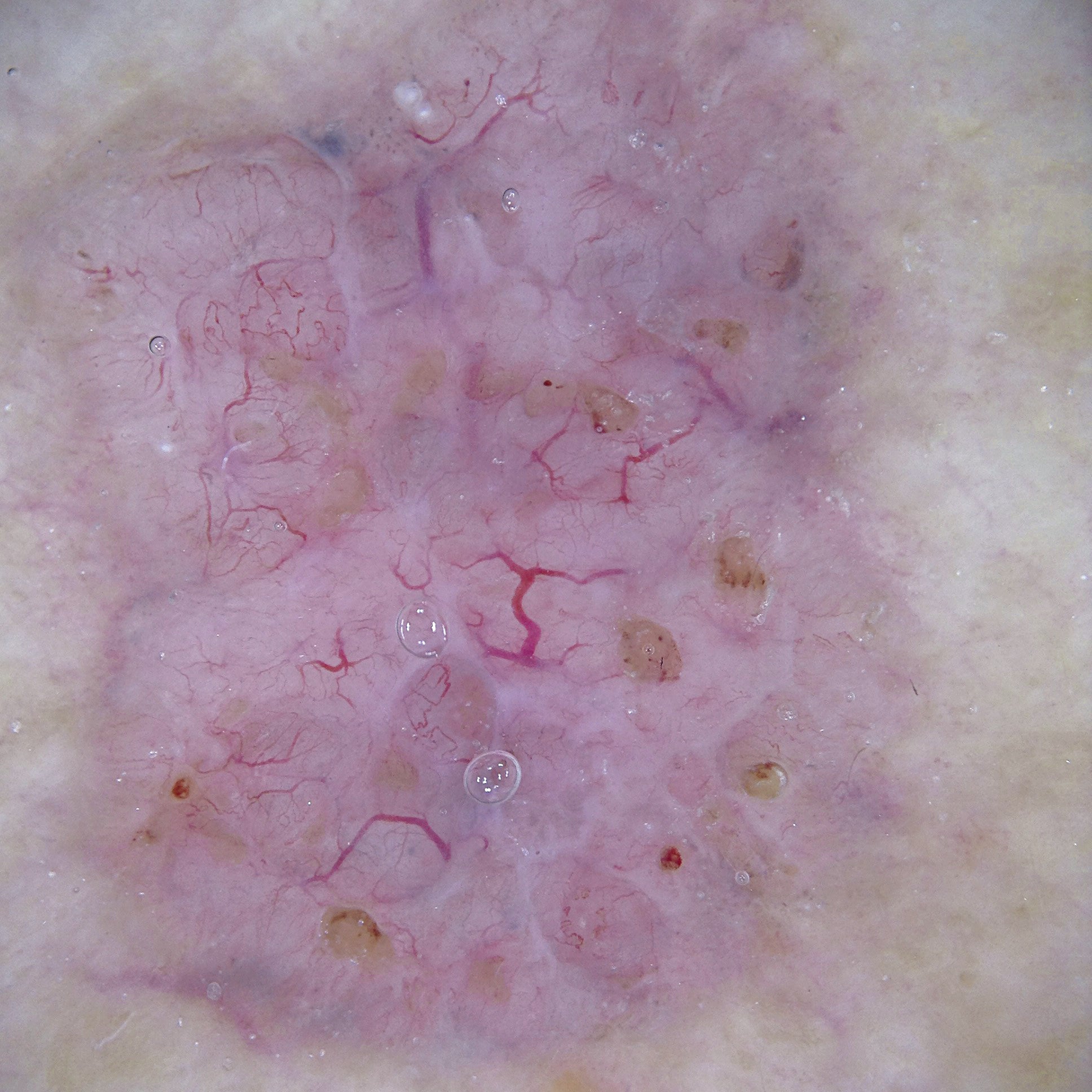
Skin image under white light