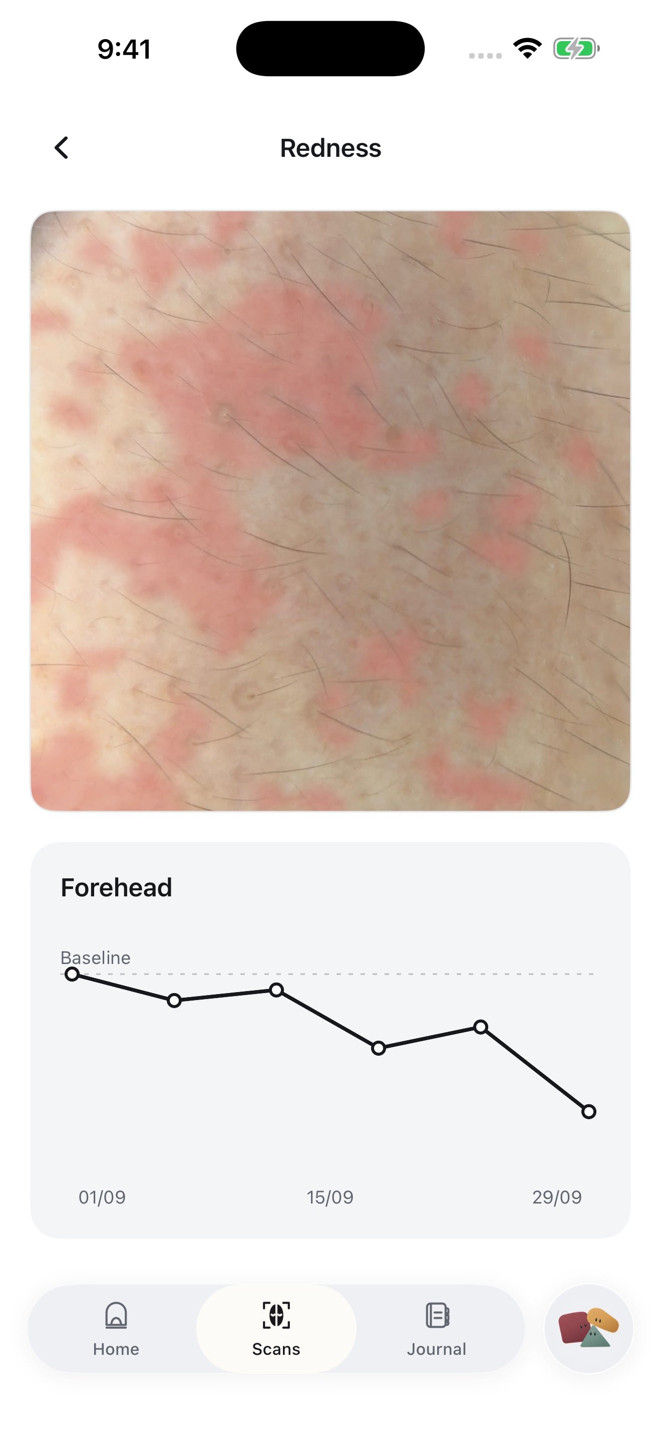 Mozi detailed scan screen with a close-up image and trend