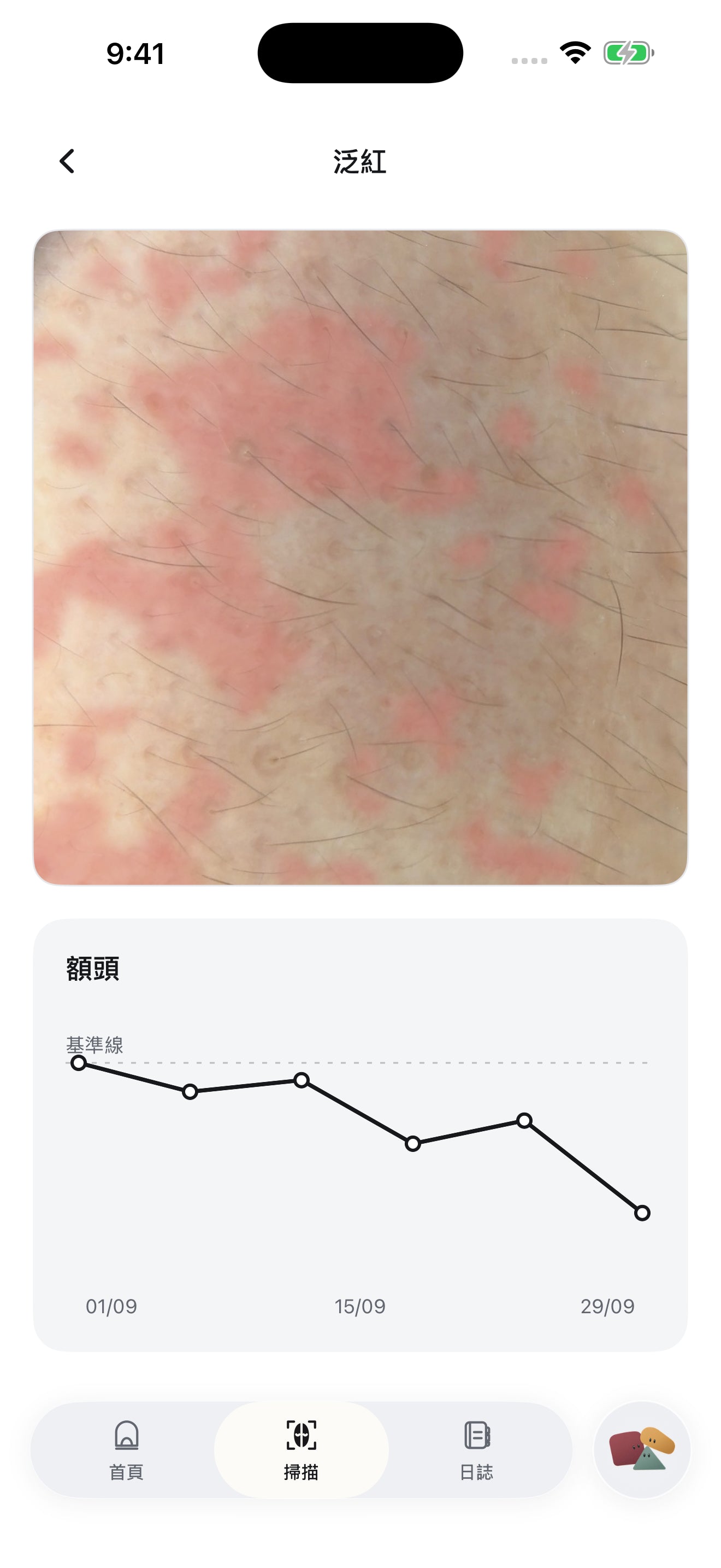 Mozi 詳細掃描畫面，顯示肌膚特寫與趨勢